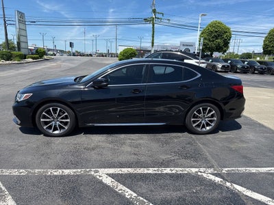2018 Acura TLX 3.5L V6 w/Technology Package