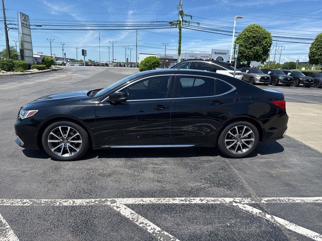 2018 Acura TLX 3.5L V6 w/Technology Package